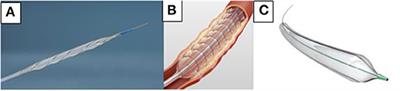 Vessel Preparation Is Essential to Optimize Endovascular Therapy of Infrainguinal Lesions